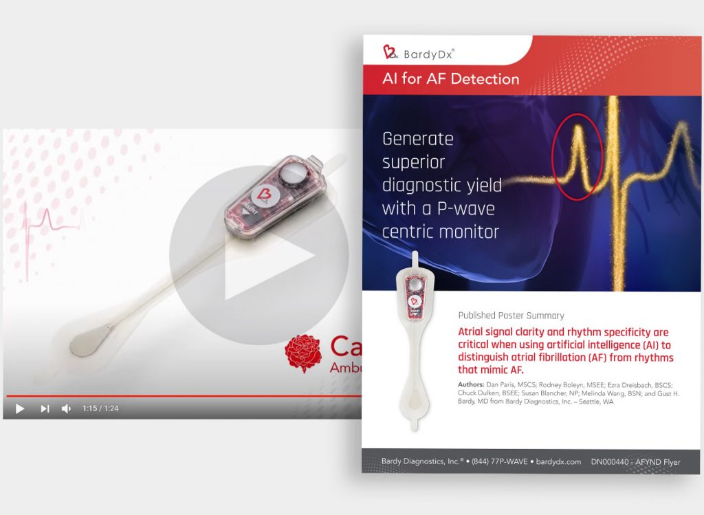 AI for Atrial Fibrillation Detection - Bardy Diagnostics